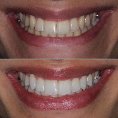 Imagem de representação do prêmio